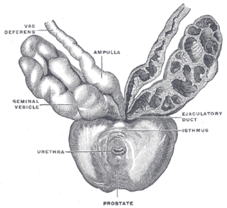 <span class="mw-page-title-main">Male accessory gland infection</span> Medical condition