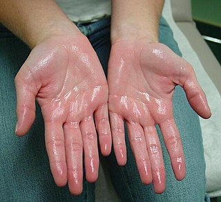 <span class="mw-page-title-main">Hyperhidrosis</span> Excessive sweating