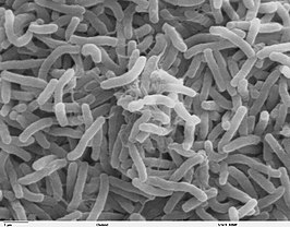 Cholerabacteriën onder de elektronenmicroscoop