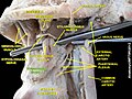 Hyoglossus muscle