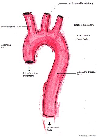 <span class="mw-page-title-main">Thoracic aorta injury</span> Medical condition