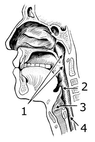 <span class="mw-page-title-main">Laryngopharyngeal reflux</span> Medical condition