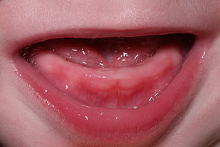 <span class="mw-page-title-main">Teething</span> Infants gaining their first teeth