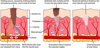 <span class="mw-page-title-main">Healing</span> Process of the restoration of health