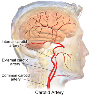 Internal carotid artery