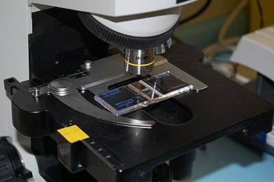 A phase-contrast microscope with a Neubauer counting chamber.