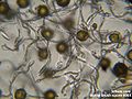 Spores and elaters from a horsetail. (Equisetum, microscopic view)