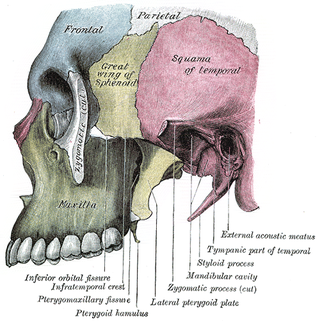 <span class="mw-page-title-main">Infratemporal fossa</span> Cavity that is part of the skull