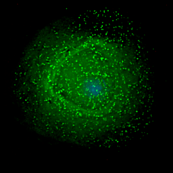 Die Menslike Immuniteitsgebreksvirus onder 'n makrofaag.