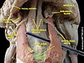 Hyoglossus muscle