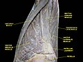 Patellar tendon. Deep dissection. Anterior view.