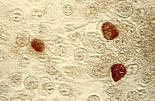 <span class="mw-page-title-main">PVC superphylum</span> Superphylum of bacteria