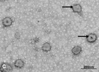 <i>Orthotospovirus</i> Genus of viruses