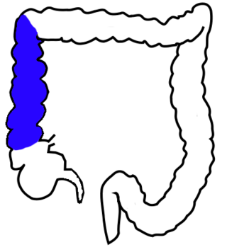 <span class="mw-page-title-main">Ascending colon</span> Section of the large intestine