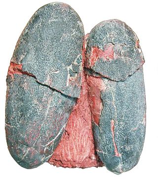 <i>Macroolithus</i> Oogenus of dinosaur egg