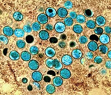 Electron micrograph of "Moneypox virus"