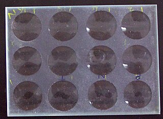 <span class="mw-page-title-main">Venereal Disease Research Laboratory test</span>