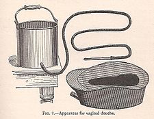 Vaginal douche apparatus with five quart tank from 1905 nursing text Vaginal douche apparatus.jpg