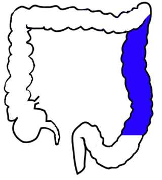 <span class="mw-page-title-main">Descending colon</span> Part of the human colon