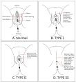 Thumbnail for version as of 18:07, 5 September 2010