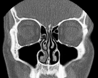 <span class="mw-page-title-main">Nasal cycle</span> Unconscious alternation of the nasal cavities