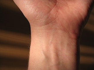 <span class="mw-page-title-main">Wrist</span> Part of the arm between the lower arm and the hand