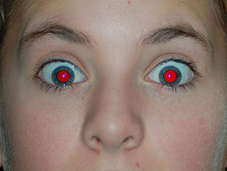 <span class="mw-page-title-main">Red-eye effect</span> Photography appearance