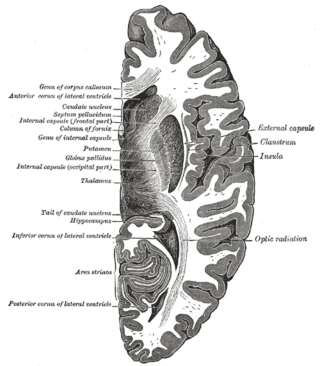 <span class="mw-page-title-main">Lentiform nucleus</span> Structure in the basal ganglia of the brain