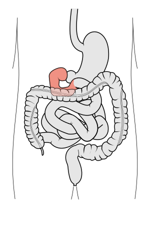 <span class="mw-page-title-main">Duodenum</span> First section of the small intestine