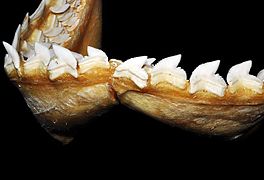 Dentes inferiores