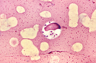 <i>Leishmania</i> Genus of parasitic flagellate protist