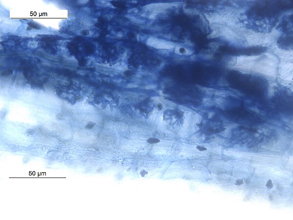 Arbuscles and hyphae in Vesicular Arbuscular Mycorhizae in root of Macrotyloma uniflorum .