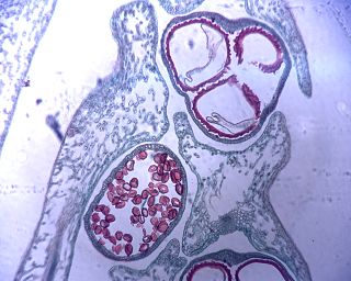 <span class="mw-page-title-main">Microspore</span> Small land plant spores that develop into male gametophytes