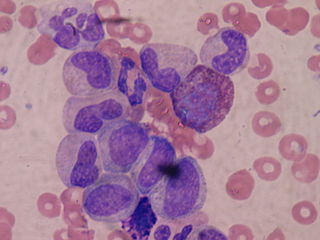 <span class="mw-page-title-main">Metamyelocyte</span>