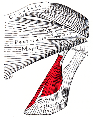 <span class="mw-page-title-main">Axillary arch</span> Muscular slip associated with latissimus dorsi muscle