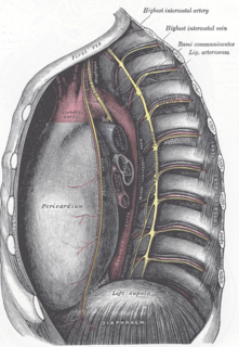 Ligamentum arteriosum