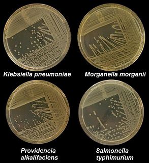 <span class="mw-page-title-main">Nutrient agar</span> Liquid medium for growing microorganisms