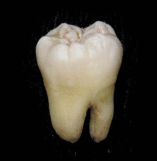 Molar (tooth) Large tooth at the back of the mouth