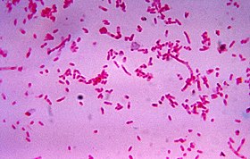 Microscopia eletrônica de uma Fusobacteria do gênero nucleatum.