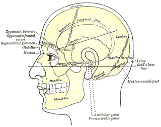 <span class="mw-page-title-main">Mastoiditis</span> Middle ear disease