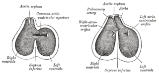 <span class="mw-page-title-main">Aorticopulmonary septum</span> Anatomical entity