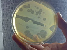 Dictyostelium aggregations on a culture plate Dictyostelium.jpg