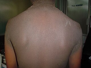 <span class="mw-page-title-main">Hyperpigmentation</span> Skin condition