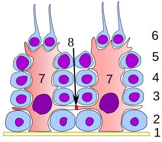 <span class="mw-page-title-main">Sertoli cell</span> Cells found in human testes which help produce sperm