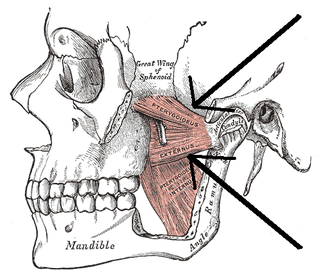 <span class="mw-page-title-main">Lateral pterygoid muscle</span> Muscle of mastication