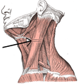 Sternocleidomastoid muscle