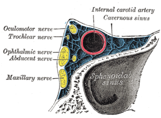 <span class="mw-page-title-main">Cavernous sinus thrombosis</span> Medical condition