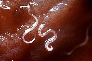 <span class="mw-page-title-main">Hookworm vaccine</span>