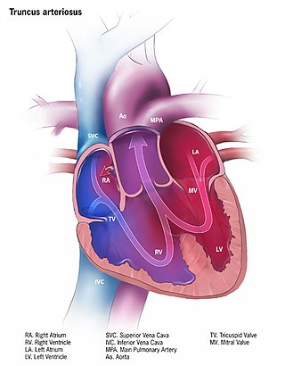 <span class="mw-page-title-main">Persistent truncus arteriosus</span> Medical condition