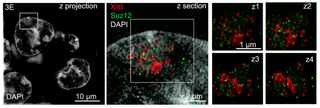 <span class="mw-page-title-main">Polycomb recruitment in X chromosome inactivation</span>